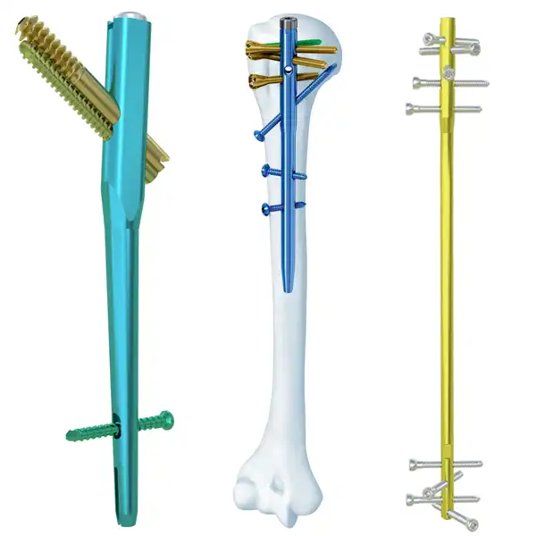 Intramedullary nail system